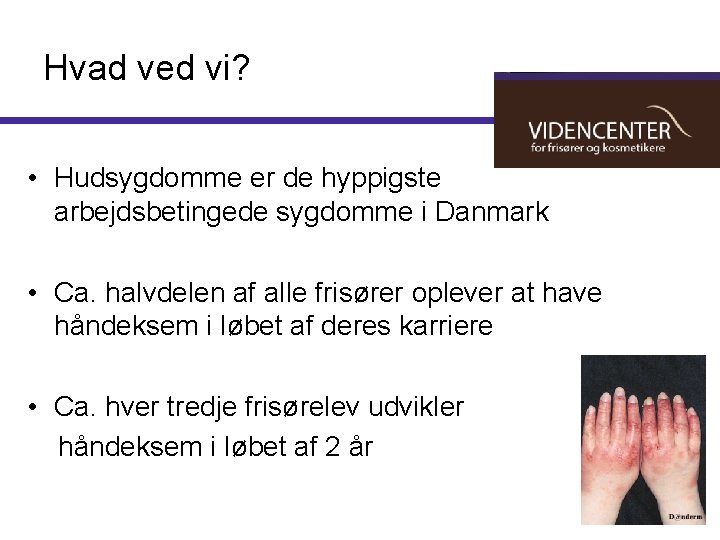 Hvad ved vi? • Hudsygdomme er de hyppigste arbejdsbetingede sygdomme i Danmark • Ca.