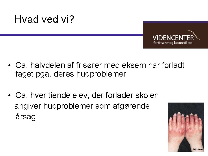 Hvad ved vi? • Ca. halvdelen af frisører med eksem har forladt faget pga.