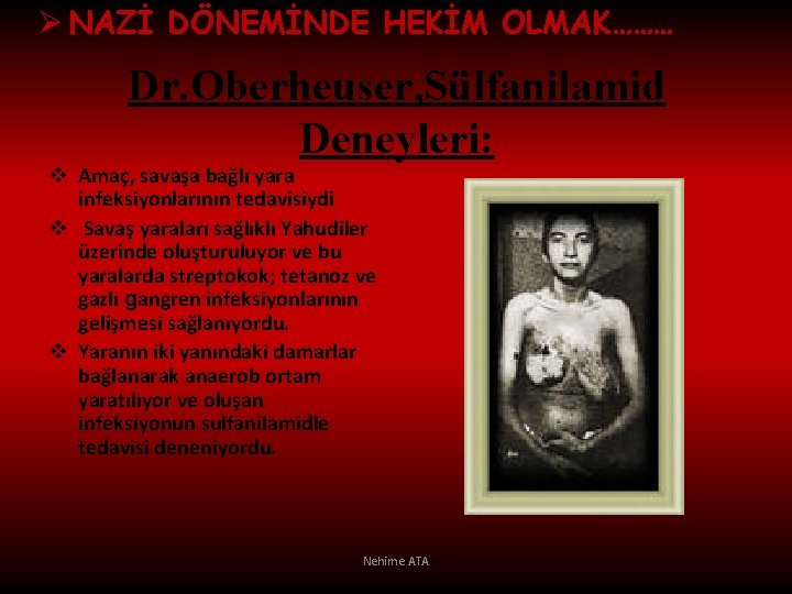 Ø NAZİ DÖNEMİNDE HEKİM OLMAK……… Dr. Oberheuser, Sülfanilamid Deneyleri: v Amaç, savaşa bağlı yara
