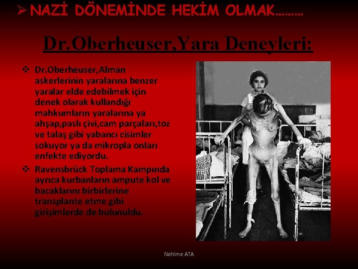 Ø NAZİ DÖNEMİNDE HEKİM OLMAK……… Dr. Oberheuser, Yara Deneyleri: v Dr. Oberheuser, Alman askerlerinin