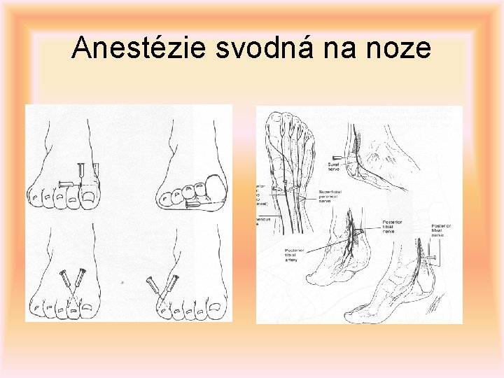 Anestézie svodná na noze 