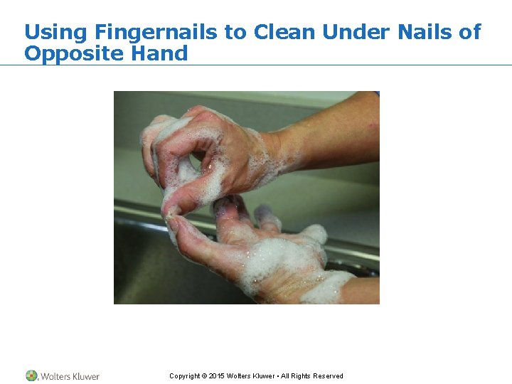 Using Fingernails to Clean Under Nails of Opposite Hand Copyright © 2015 Wolters Kluwer