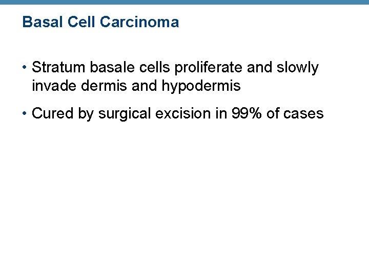 Basal Cell Carcinoma • Stratum basale cells proliferate and slowly invade dermis and hypodermis