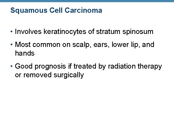 Squamous Cell Carcinoma • Involves keratinocytes of stratum spinosum • Most common on scalp,