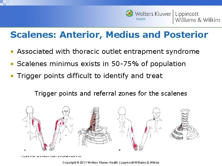 Scalenes: Anterior, Medius and Posterior • Associated with thoracic outlet entrapment syndrome • Scalenes