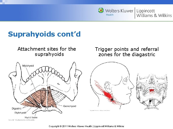Suprahyoids cont’d Attachment sites for the suprahyoids Trigger points and referral zones for the