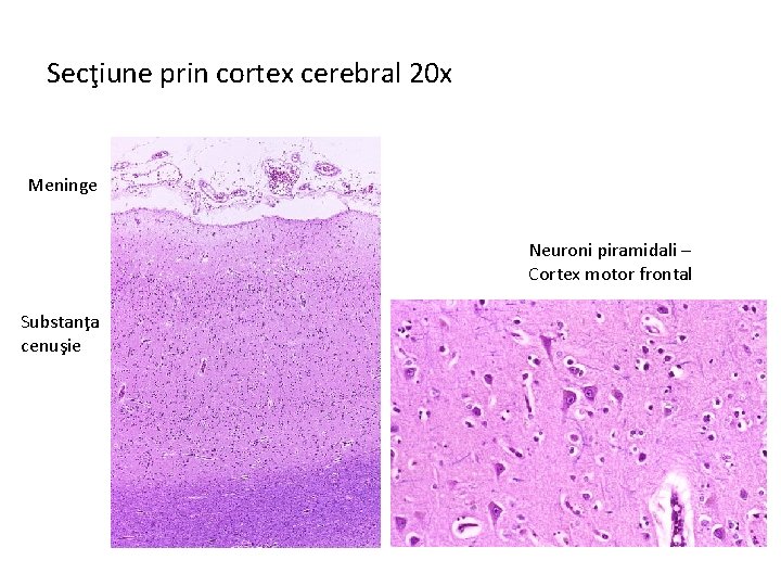 Secţiune prin cortex cerebral 20 x Meninge Neuroni piramidali – Cortex motor frontal Substanţa