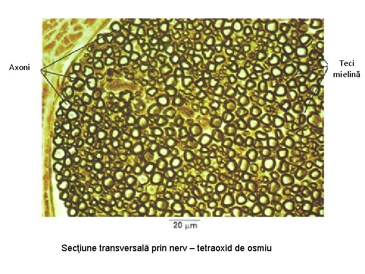 Teci mielină Axoni Secţiune transversală prin nerv – tetraoxid de osmiu 