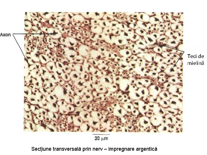 Teci de mielină Secţiune transversală prin nerv – impregnare argentică 