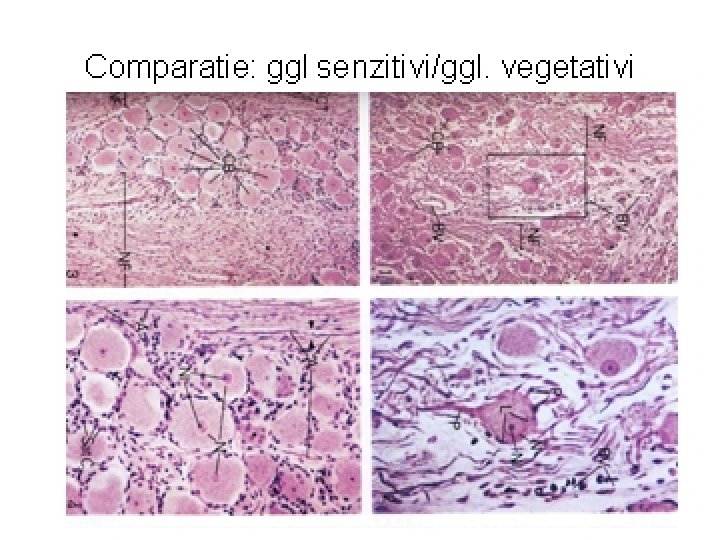 SISTEM NERVOS PERIFERIC GANGLION SPINAL – H&E GANGLION VEGETATIV H&E 