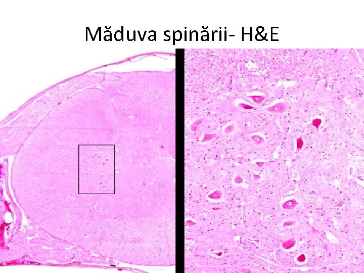 Măduva spinării- H&E 