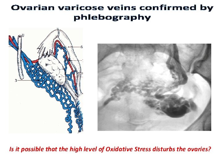 Is it possible that the high level of Oxidative Stress disturbs the ovaries? 