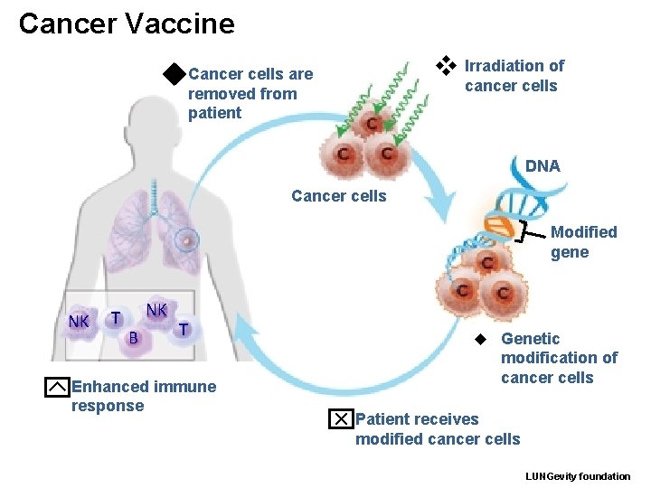 Cancer Vaccine v Irradiation of u Cancer cells are removed from patient cancer cells