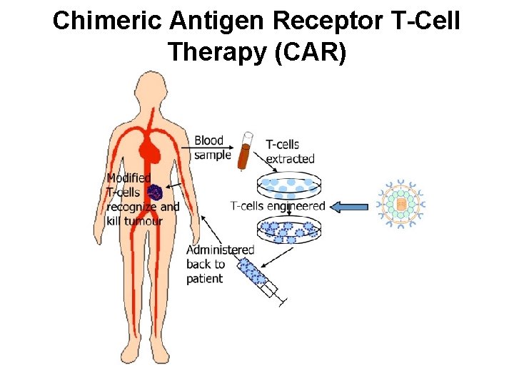 Chimeric Antigen Receptor T-Cell Therapy (CAR) 
