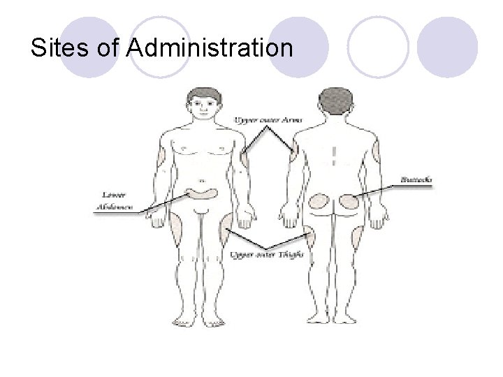 Sites of Administration 