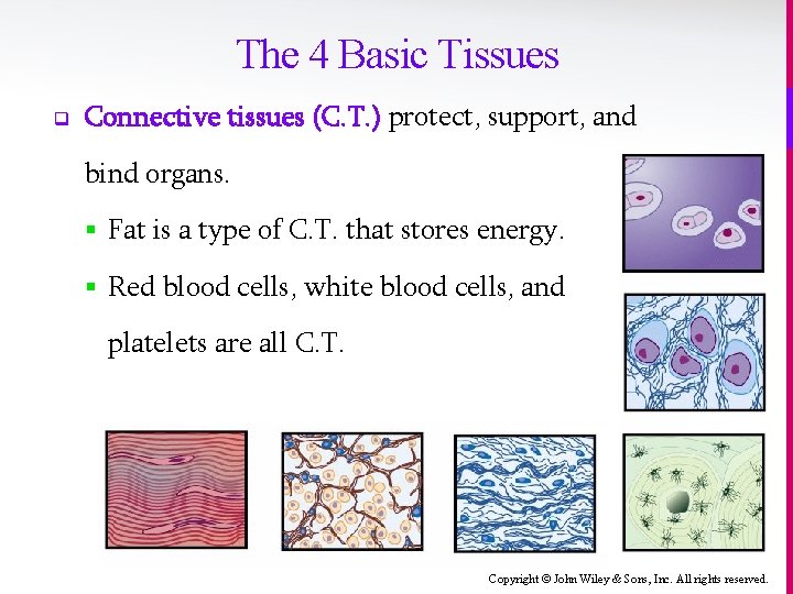 The 4 Basic Tissues q Connective tissues (C. T. ) protect, support, and bind