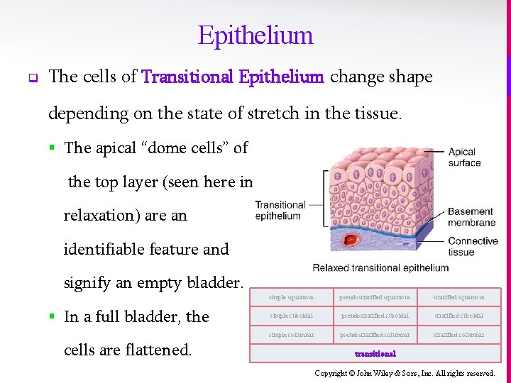 Epithelium q The cells of Transitional Epithelium change shape depending on the state of