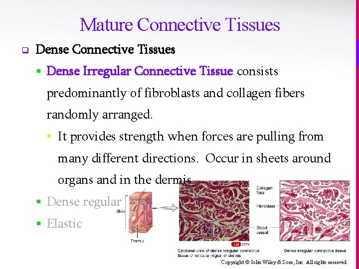 Mature Connective Tissues q Dense Connective Tissues § Dense Irregular Connective Tissue consists predominantly