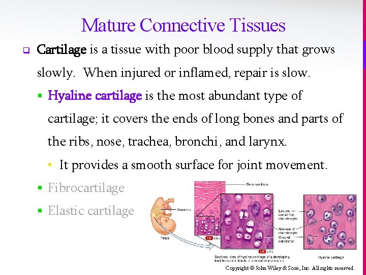 Mature Connective Tissues q Cartilage is a tissue with poor blood supply that grows