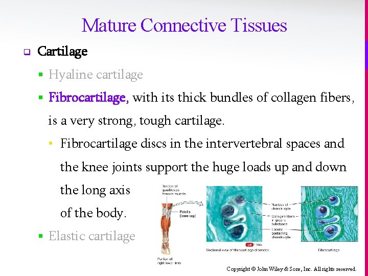 Mature Connective Tissues q Cartilage § Hyaline cartilage § Fibrocartilage, with its thick bundles