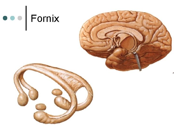 Fornix 