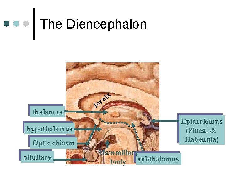 The Diencephalon x i n r thalamus fo Epithalamus (Pineal & Habenula) hypothalamus Optic