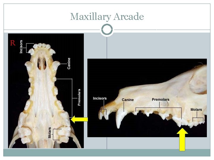 Maxillary Arcade R 