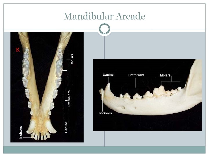 Mandibular Arcade R 