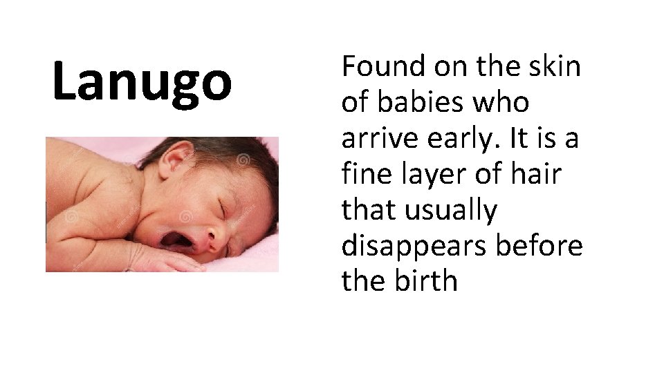 Lanugo Found on the skin of babies who arrive early. It is a fine