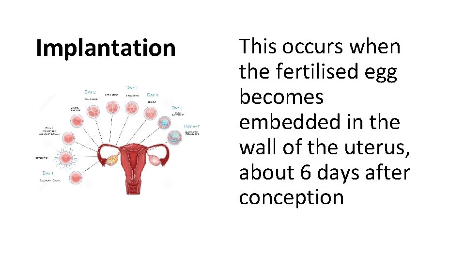 Implantation This occurs when the fertilised egg becomes embedded in the wall of the