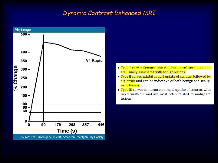 Dynamic Contrast Enhanced MRI 