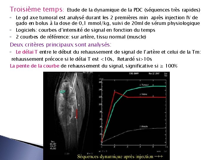 Troisième temps: Etude de la dynamique de la PDC (séquences très rapides) Le gd