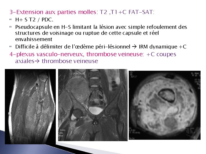 3 -Extension aux parties molles: T 2 , T 1+C FAT-SAT: H+ S T