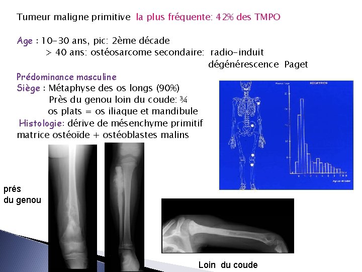 Tumeur maligne primitive la plus fréquente: 42% des TMPO Age : 10 -30 ans,