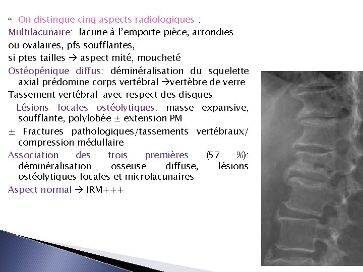 On distingue cinq aspects radiologiques : Multilacunaire: lacune à l’emporte pièce, arrondies ou ovalaires,