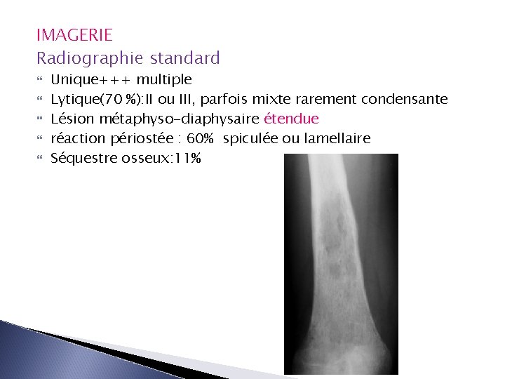 IMAGERIE Radiographie standard Unique+++ multiple Lytique(70 %): II ou III, parfois mixte rarement condensante