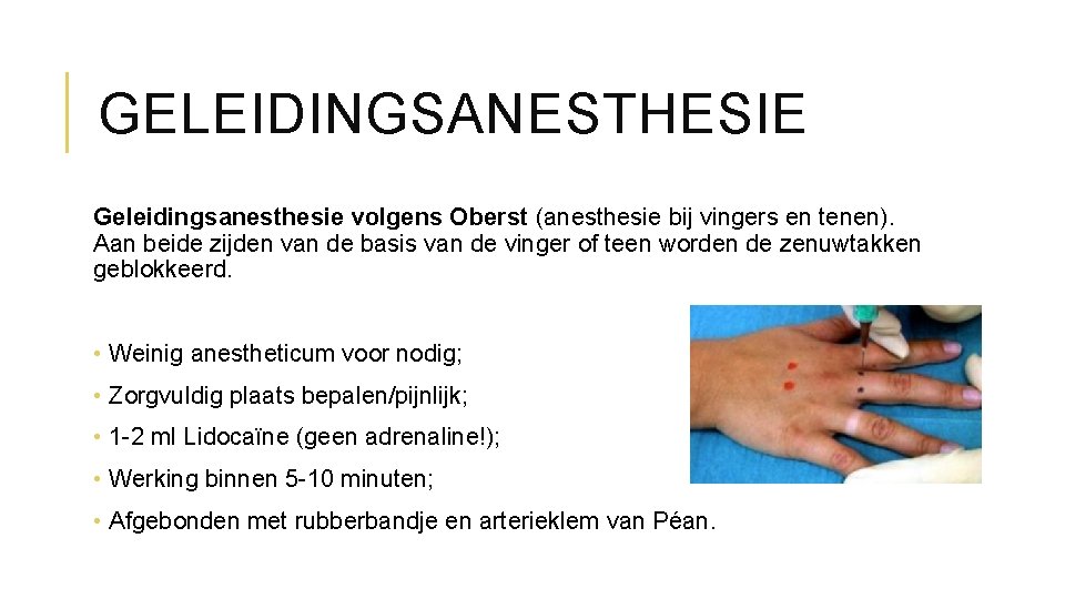 GELEIDINGSANESTHESIE Geleidingsanesthesie volgens Oberst (anesthesie bij vingers en tenen). Aan beide zijden van de