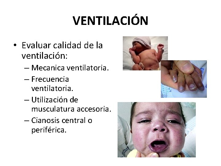 VENTILACIÓN • Evaluar calidad de la ventilación: – Mecanica ventilatoria. – Frecuencia ventilatoria. – VENTILACIÓN • Evaluar calidad de la ventilación: – Mecanica ventilatoria. – Frecuencia ventilatoria. –