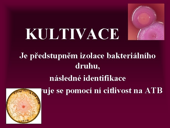 KULTIVACE Je předstupněm izolace bakteriálního druhu, následné identifikace a stanovuje se pomocí ní citlivost