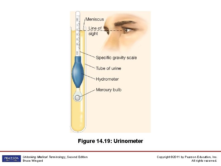 Figure 14. 19: Urinometer Unlocking Medical Terminology, Second Edition Bruce Wingerd Copyright © 2011
