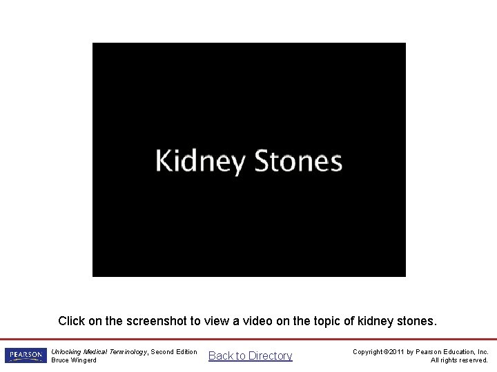 Kidney Stones Video Click on the screenshot to view a video on the topic