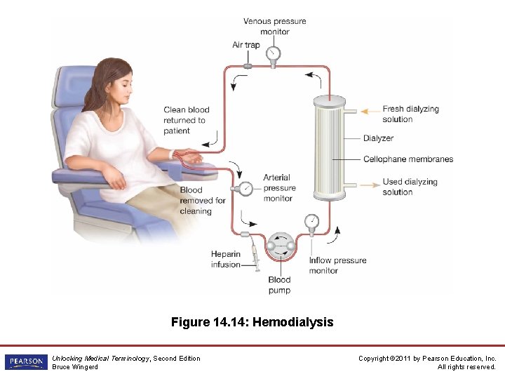 Figure 14. 14: Hemodialysis Unlocking Medical Terminology, Second Edition Bruce Wingerd Copyright © 2011