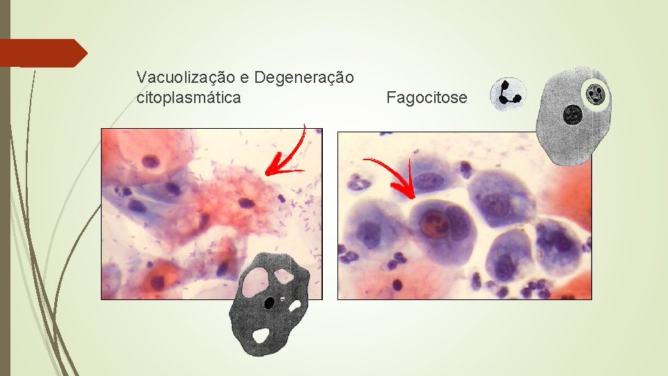 Vacuolização e Degeneração citoplasmática Fagocitose 