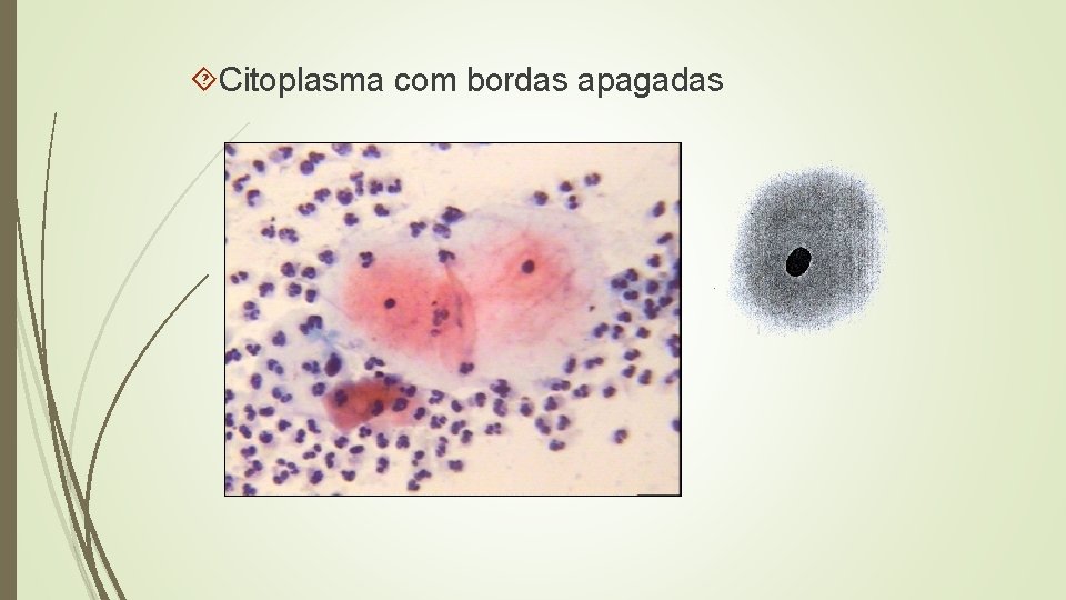  Citoplasma com bordas apagadas 