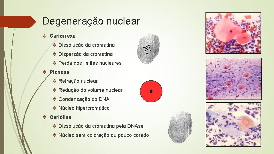 Degeneração nuclear Cariorrexe Dissolução da cromatina Dispersão da cromatina Perda dos limites nucleares Picnose