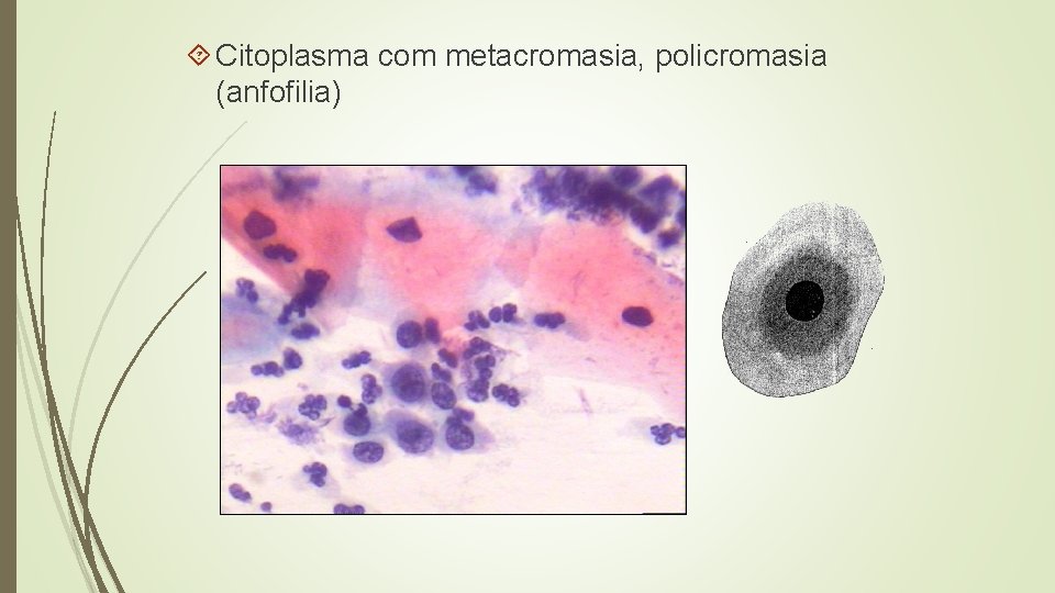  Citoplasma com metacromasia, policromasia (anfofilia) 