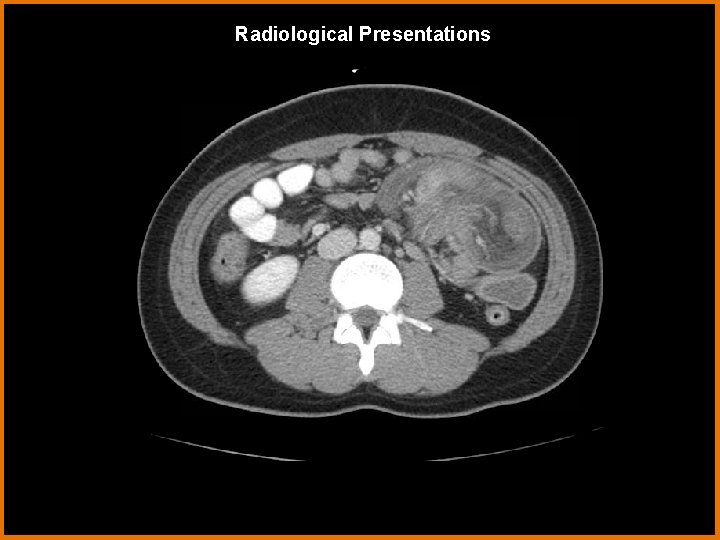 Radiological Presentations 