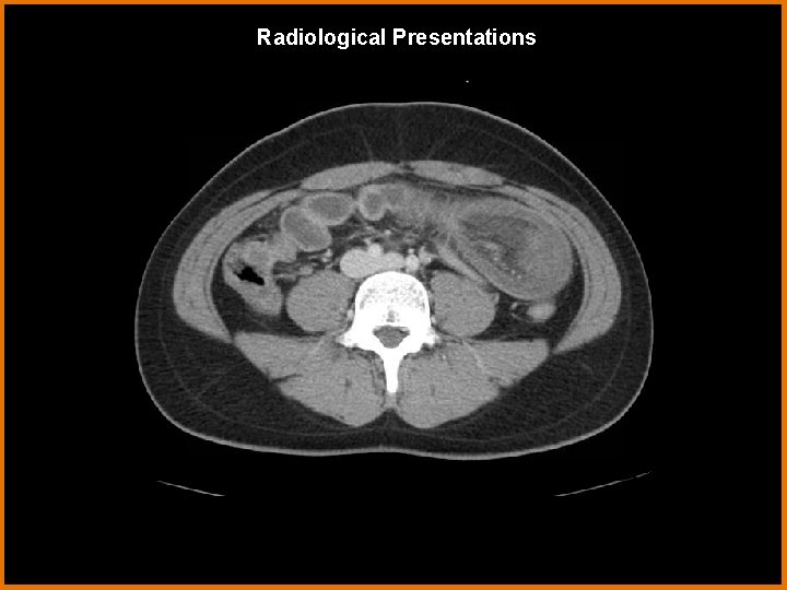 Radiological Presentations 