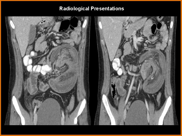 Radiological Presentations 