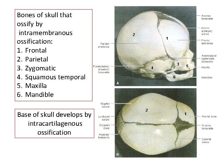 Bones of skull that ossify by intramembranous ossification: 1. Frontal 2. Parietal 3. Zygomatic